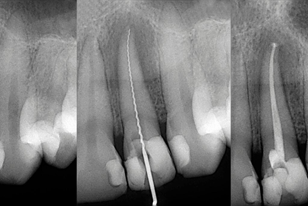 endodontia