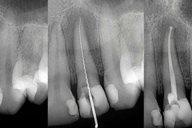 endodontia