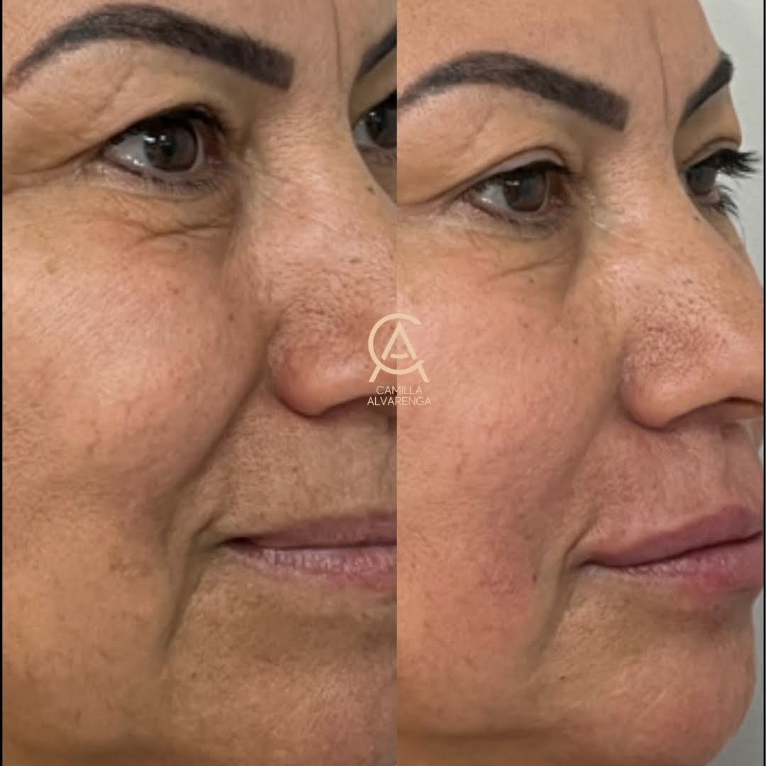 Camilla Bigode Chines